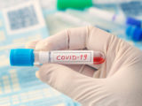 Coronavirus 2019-nCoV Blutprobe