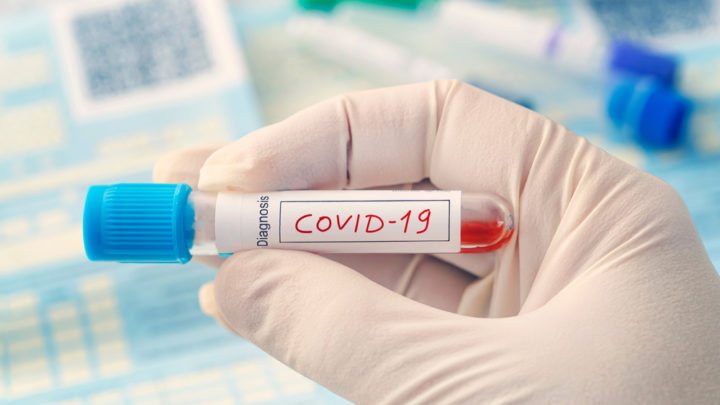 Antikörper gegen SARS-CoV-2 – Covid-19-Erkrankung wie auch Corona-Impfung bauen Immunität auf